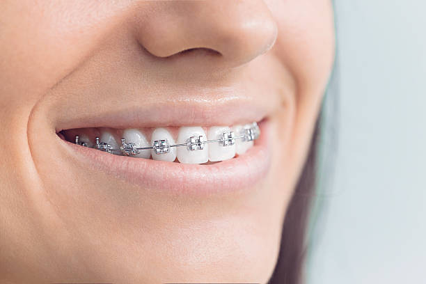 Best Dental Fillings (Composite and Amalgam)  in Orleans, IN